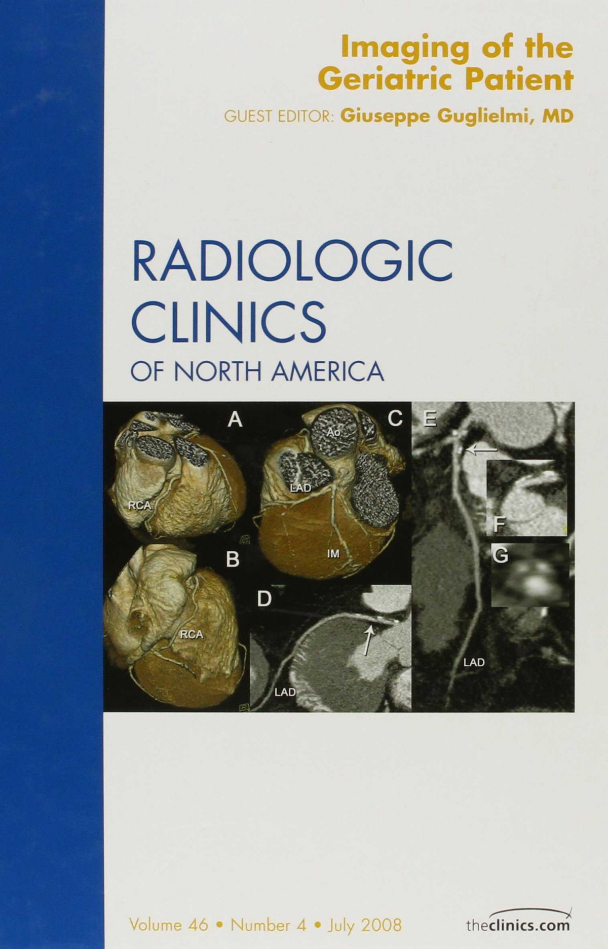 Imaging of the Geriatric Patient, an Issue of Radiologic Clinics