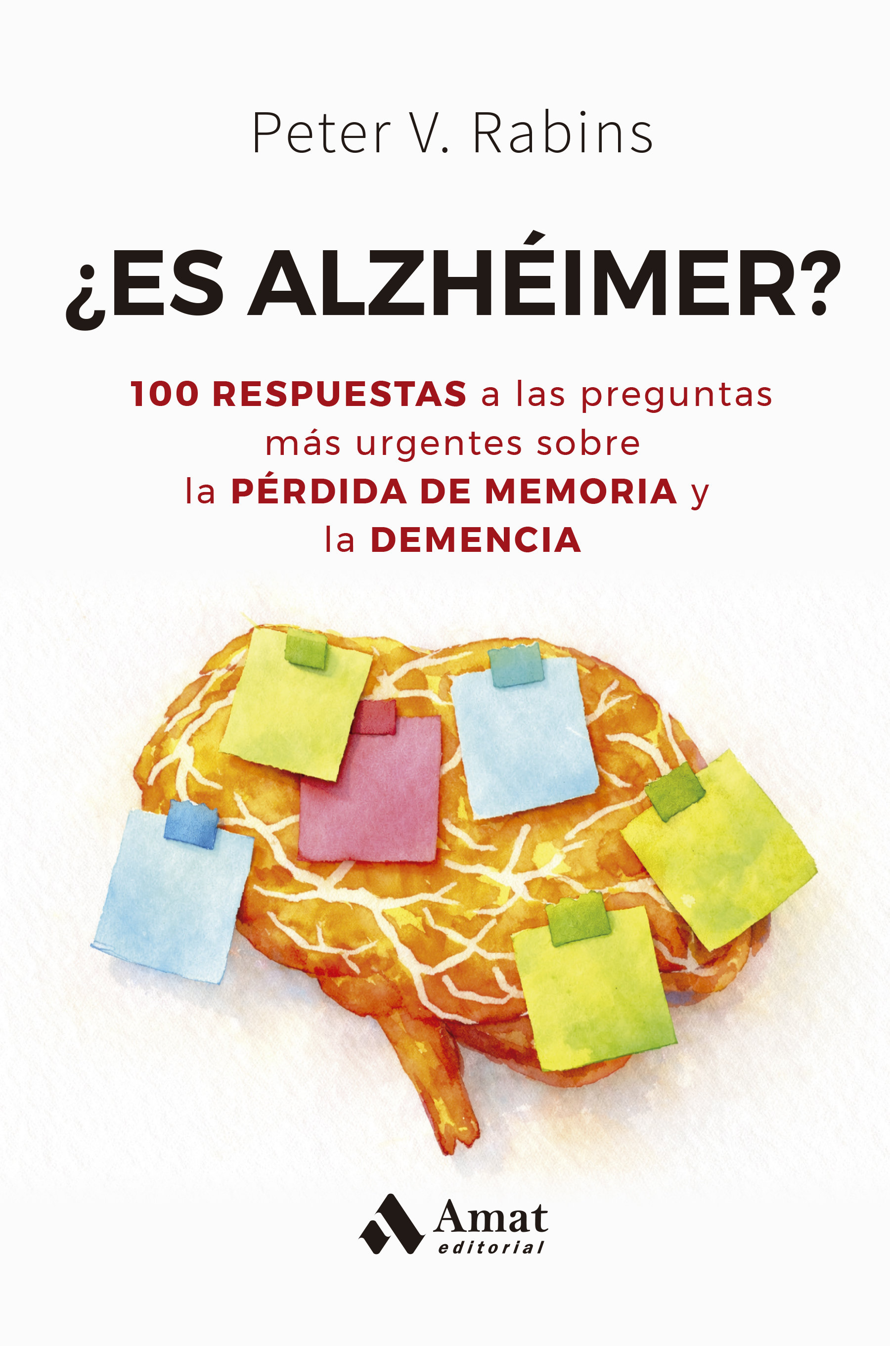 �Es alzheimer?