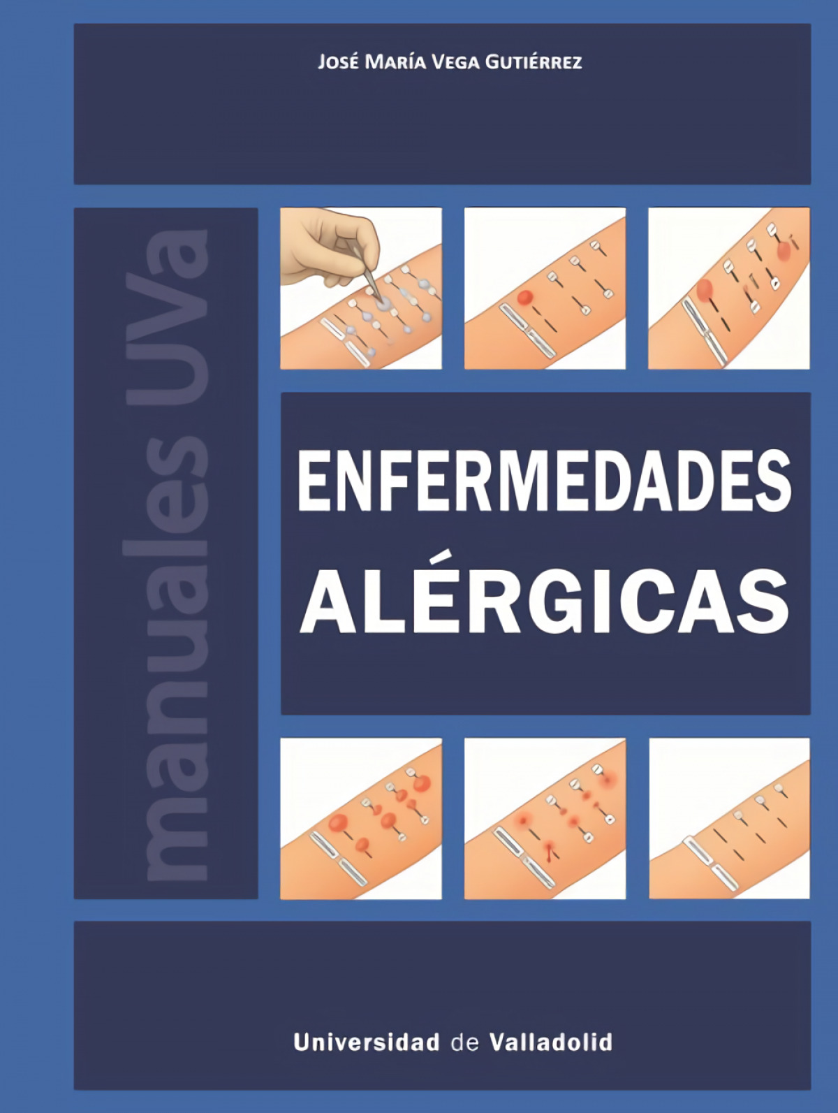 Enfermedades al�rgicas