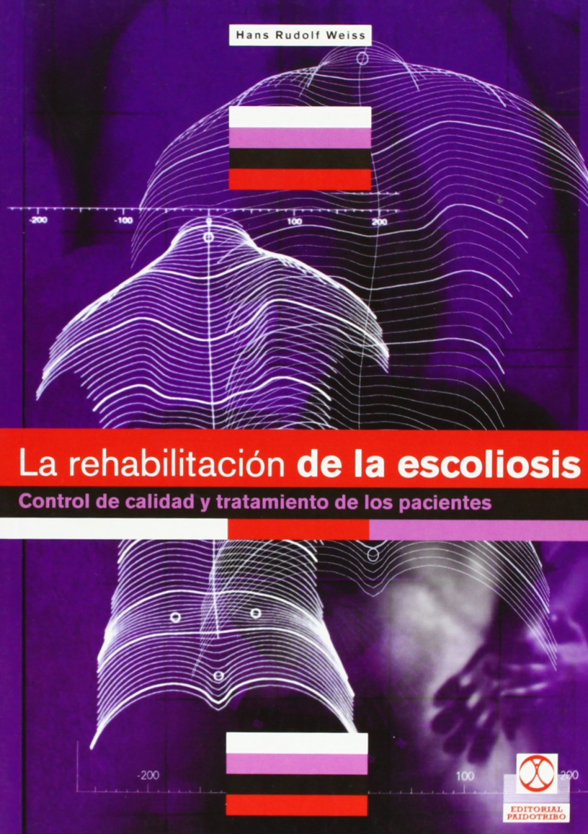 LA REHABILITACION DE LA ESCOLIOSIS