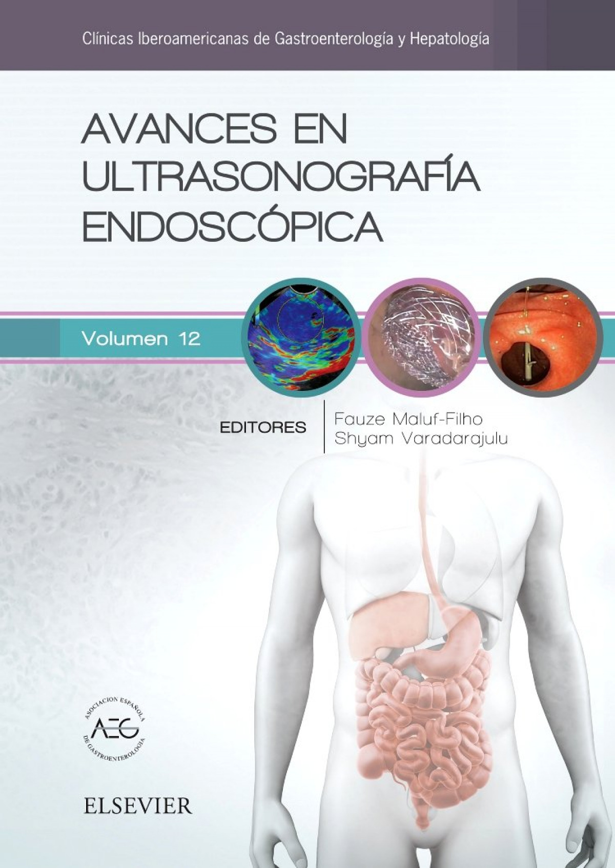 Avances en ultrasonografÍa endoscÓpica - Vv.Aa.