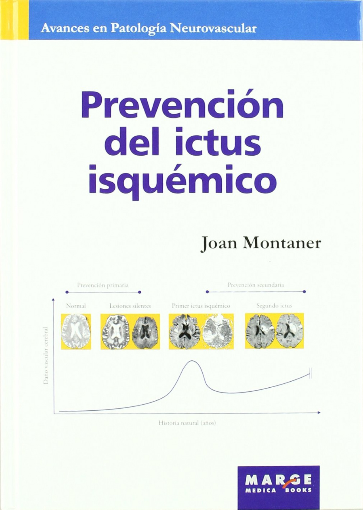 Prevención del ictus isquémico - Montaner, Joan