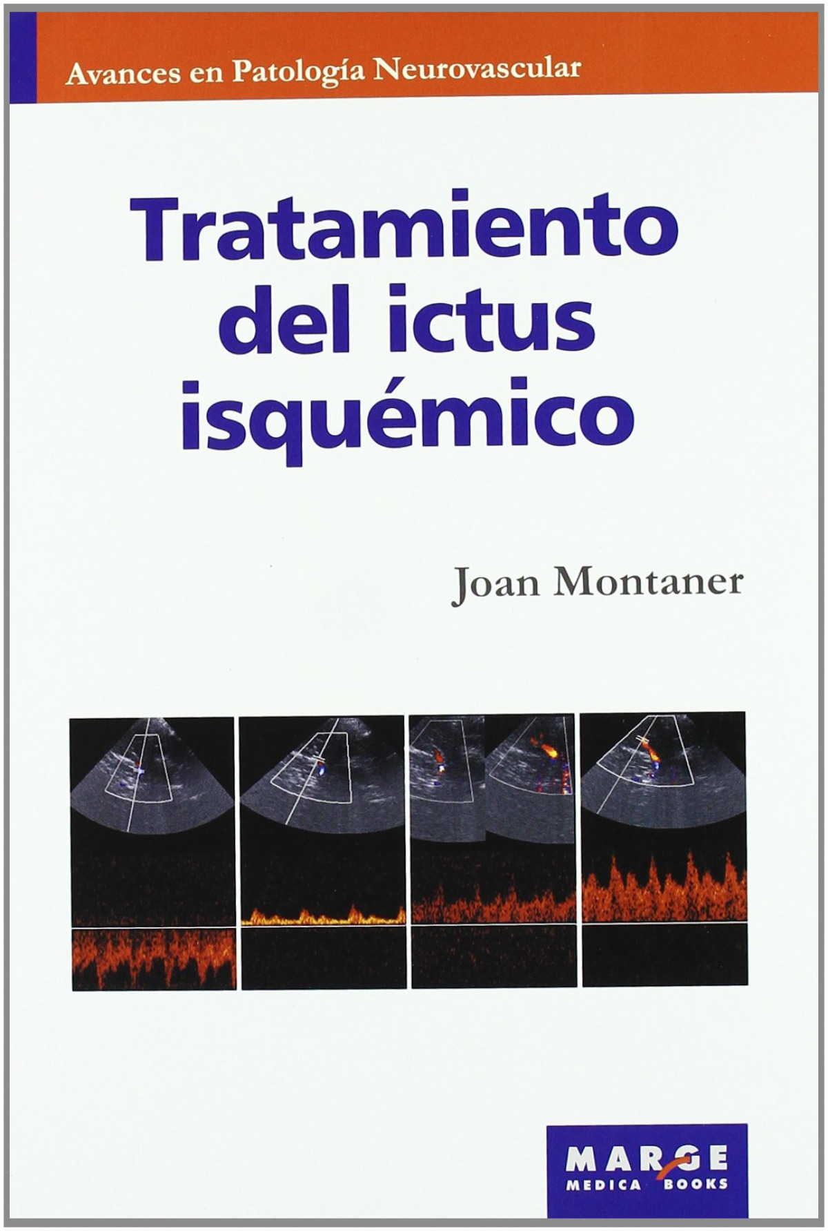 Tratamiento del ictus isquémico - Montaner, Joan