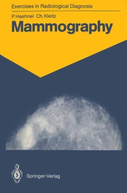 MAMMOGRAPHY