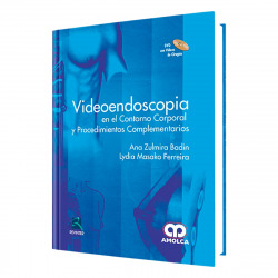 Videoendescopia