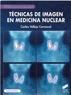 Técnicas de imagen de medicina nuclear
